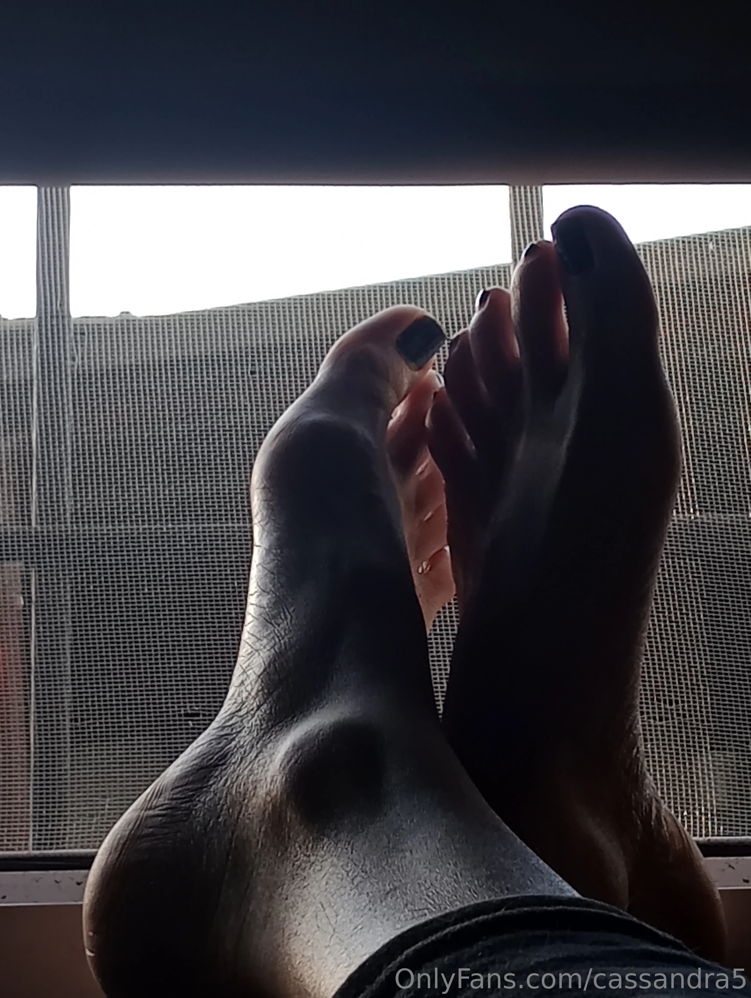 Hairy Cass photo #13